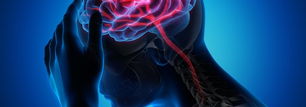 An illustration of a stroke happening in the brain